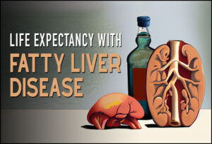 Life Expectancy with Fatty Liver Disease